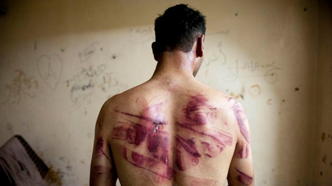 Canadian government apologizes to citizens tortured in Syria