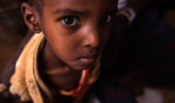 The First Faces Of Famine In Somalia