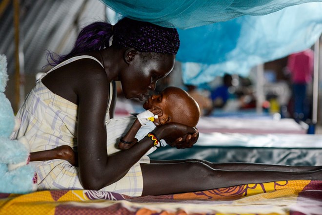 In South Sudan, a mother kisses her baby, who is suffering from severe acute malnutrition with complications, including tuberculosis. Photo: UNICEF/Sebastian Rich