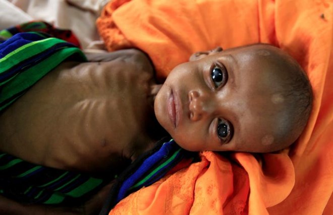 FILE PHOTO: An unidentified severely malnourished Somali refugee child rests inside a ward at the Medecins Sans Frontieres (MSF) hospital at the Dagahale refugee camp in Dadaab, near the Kenya-Somalia border, in Garissa County, Kenya July 28, 2011. REUTERS/Thomas Mukoya/File Photo